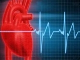  محققان می گویند؛ سابقه خانوادگی بیماری قلبی و ریسک کلسترول بالا در کودکان