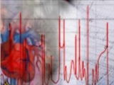 عامل 41.43 درصد مرگ و مير در آذربايجان شرقي بيماري‌هاي قلبي است 