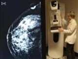 سازمان غذا و داروی آمریکا ماموگرافی سه‌بعدی را تایید کرد 