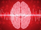  سیستم جدید هوش مصنوعی علائم مغزی را به سخنرانی مبدل می کند