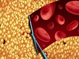 توسعه داروی بدون عوارض برای کاهش کلسترول خون