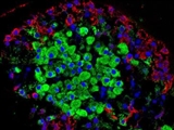 درمان دیابت با سلول‌هایی که به کمک نور فعال می‌شوند