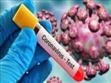  آزمایش تشخیصی ویروس کرونا از فردا در تبریز انجام می‌شود
