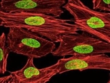 از بین بردن سلول‌های سرطانی به روشی متفاوت