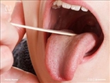 چرا دهان خشک می‌شود و راه درمان آن چیست؟