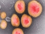  کشف ۳۰ هزار ویروس جدید در دی‌ان‌ای میکروب‌ها