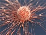 راه حل جدید محققان ایرانی برای درمان مؤثر تومورهای سرطانی
