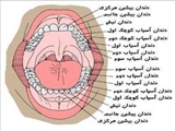 بهداشت بد دهان و دندان با بیماری قلبی ارتباط دارد 