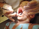 درمان ريشه به جاي ‌كشيدن دندان 