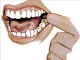 سايش دندان 