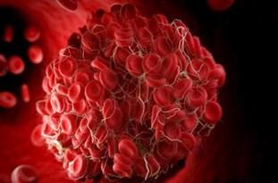 عوامل خطر آفرین لخته شدن خون