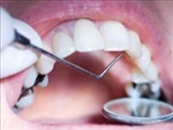 ساخت ماده‌اي براي ترميم دندان 