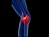 شیوع بالای ابتلا به ناپایداری های مفصل زانو در کشور