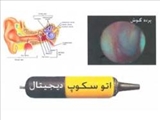 ساخت اتوسكوپ ديجيتال معاينه گوش در ايران 