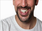  توسعه دارویی که احتمالاً موجب رشد مجدد دندان‌ها می‌شود