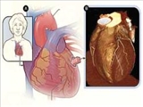 سكته قلبي كشنده‌تر از سكته مغزي 