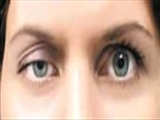 شيوه جراحي پلك‌ها 