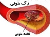 خطرات لخته شدن خون در رگ ها 