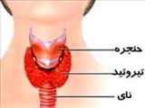 وقتی تیروئید تنبل می شود 