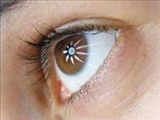 وقتي قرنيه چشم كدر مي‌شود 