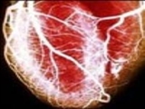 سلول‌های بنیادی "مغناطیسی" برای درمان بیماری قلبی