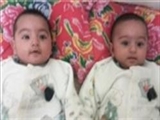 روزانه چند دوقلو در کشور متولد می‌شوند 
