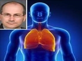کشف یک پروتئین بسیار مؤثر در بیماری‌های ریوی با همکاری محقق ایرانی 