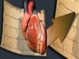 آریتمی قلبی را جدی بگیرید 