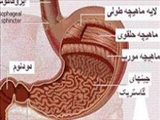  عاملی که موجب بروز رفلاکس معده می‌شود 