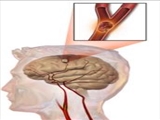 تاثیر دیر شام خوردن بر روی حافظه 