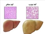 کبد چرب عامل دیابت، فشار خون و بیماری‌های قلبی است