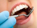 ارائه یک روش درمانی جدید در ارتودونسی/ کاهش فشار به استخوانها و فک