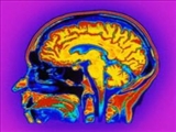 عمر مغز کمتر از تصورات پیشین است 