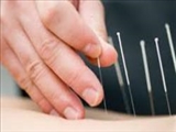 طب سوزنی، راه درمان همه بیماری ها 
