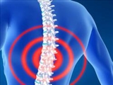 ساخت ایمپلنت نخاعی برای کاهش درد ستون فقرات