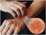 علت دقیق خارش پوست بدن